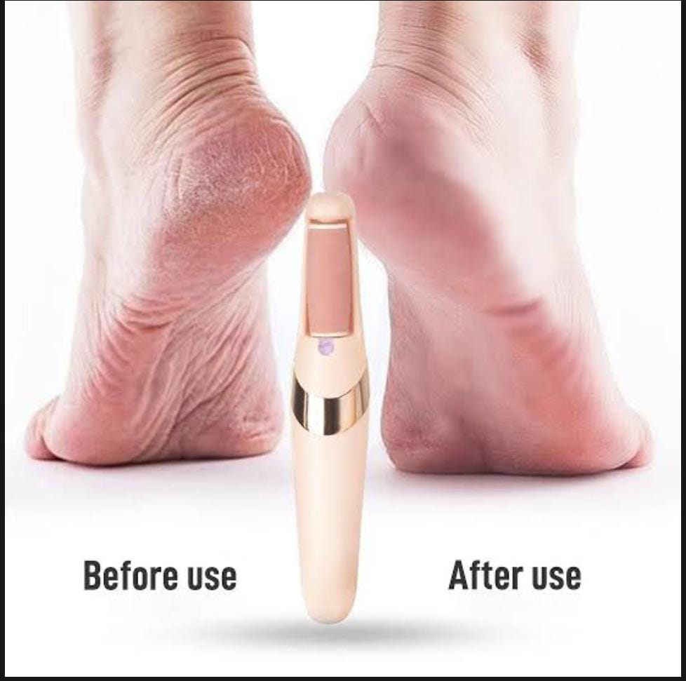 Electric Pedicure Tools File Leg Heels Remove Hard Cracked Dead Skin Callus